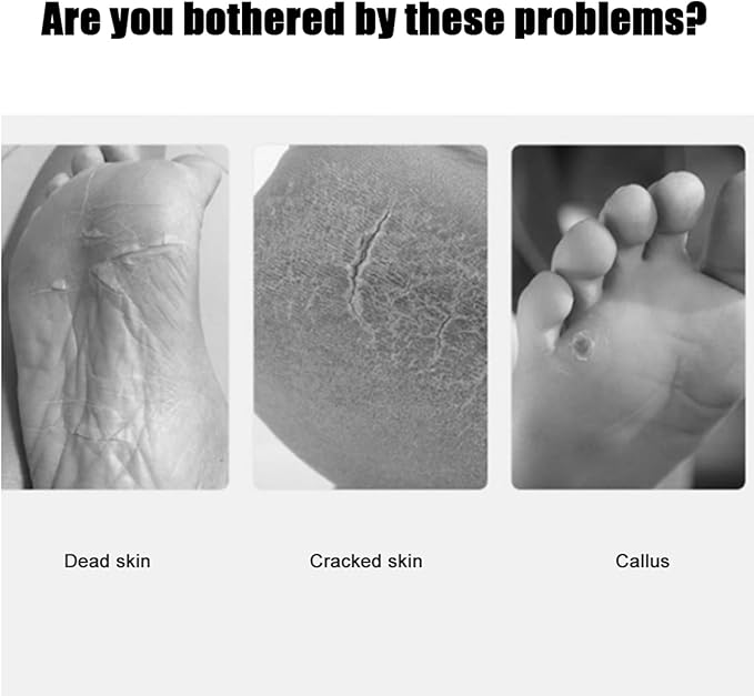 Electric Foot Callus Remover, Electric Foot File with 60pcs Sharpener, Electric Foot Filter for Remove Chapped Dry Dead Skin and Calluses on The Heel (US Plug 100-240V)