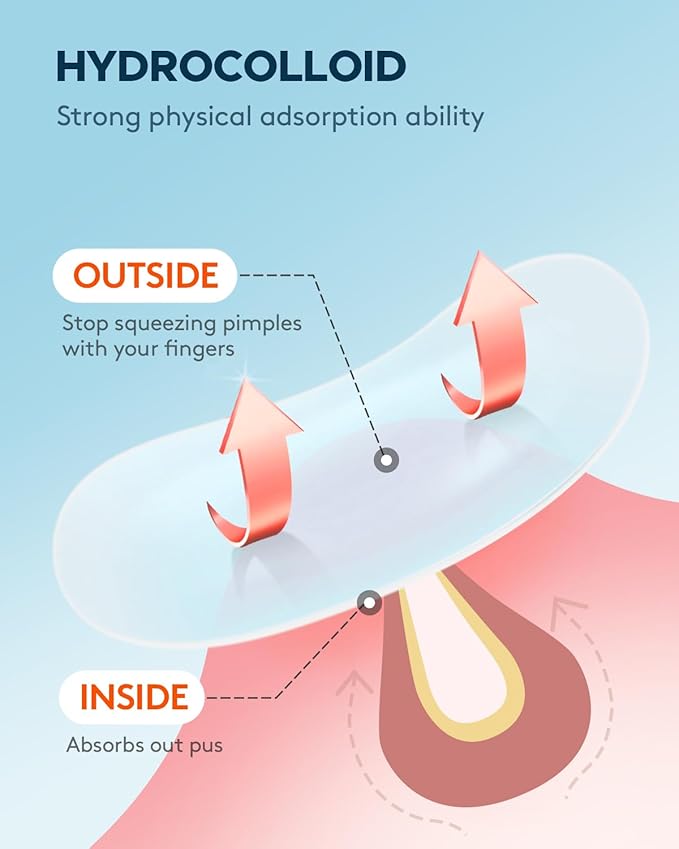 LitBear Large Acne Pimple Patches, 6 Sizes 100 Patches for Large Breakouts, Acne Patches for Face, Chin or Body, Acne Spot Patch with Tea Tree & Calendula Oil, Hydrocolloid Bandages for Acne Skin