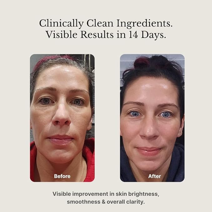 MAXDAHLIA Cell Active Day Serum | 10X Antioxidant Protection | Small-Batch Non-Oxidizing 20% Vitamin C+E Ferulic Acid with Niacinamide & Hyaluronic Acid | Anti-Aging, Brightening, Dark Spot Corrector