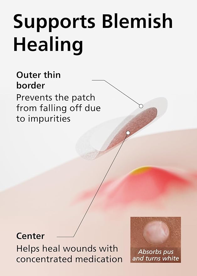 EasyDerm Beauty Patch(84 Counts) - 100% Hydrocolloid Pimple Patch for Zit Spot Care, K-beauty, Daewoong Pharmaceutical, Korean Acne Patches Stocking Stuffer Holiday Gift