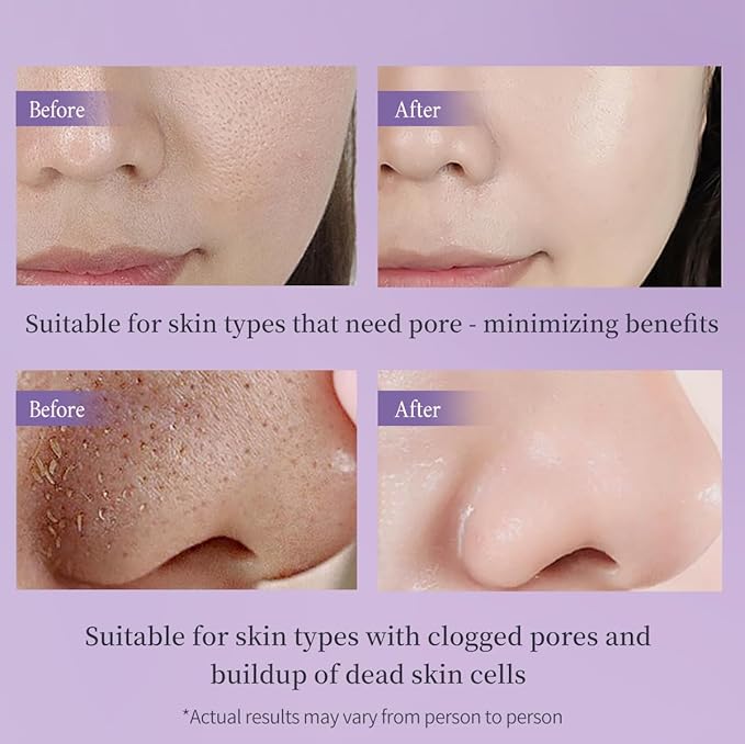 Facial Peeling Gel, Gentle Facial & Body Exfoliator Body Scrub for Removing Dead Skin Cells, Skin Renewal for Women & Men- 2.03 fl oz