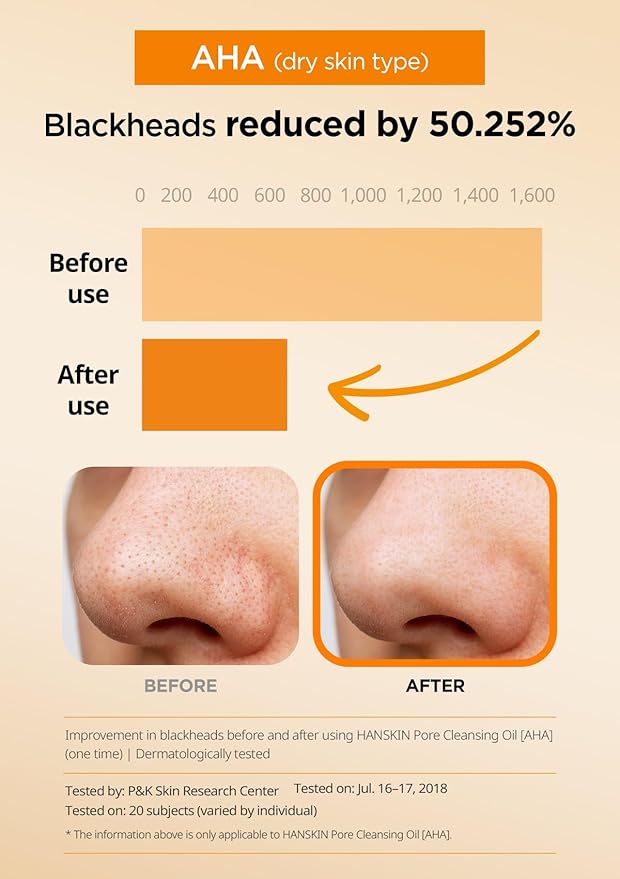 Hanskin AHA Pore Cleansing Oil for Dry Skin, Exfoliating, Waterproof Makeup Sebum Remover Facial Oil Cleanser for Face, Moisturizing for Soft Skin, Korean Skincare [AHA/10.14 oz.]