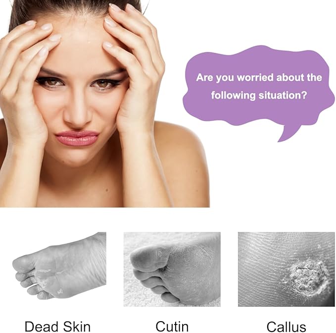 Foot Brush and Pumice Stone - 4 Pack Foot Brush Scrubber for Shower 4 in 1 Pedicure Foot File Exfoliator for Foot Care - Purple and Blue