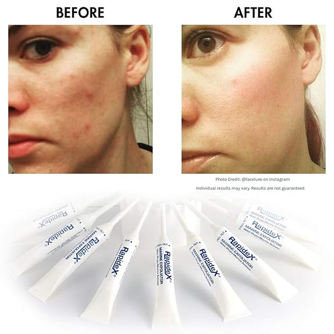 Repechage Rapidex Marine Exfoliator - Natural Facial Exfoliating Scrub with Glycolic & Alpha Hydroxy Acids - Deep Pore Cleansing Gentle Face Exfoliator for Anti-Aging