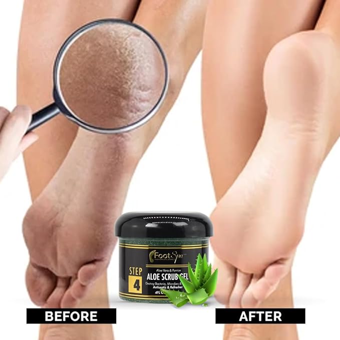 FOOT SPA - Exfoliating Scrub Gel, 4 Oz - Manicure, Pedicure and Body Exfoliator Infused with Aloe Vera and Salicylic Acid - Glow, Polish, Smooth and Moisture Skin - Body, Hand and Foot