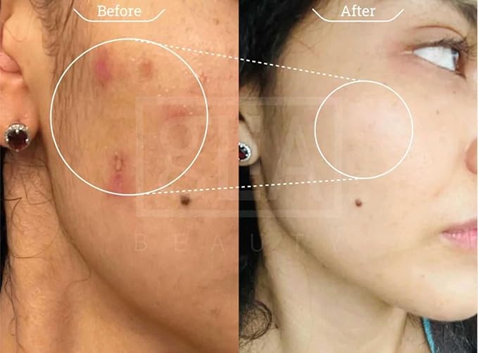 Face Mask, Anti-Aging Sheet Mask with Stem Cell Growth Factors, Hydrating, Rejuvenating, Bio-Cellulose, 4 Count