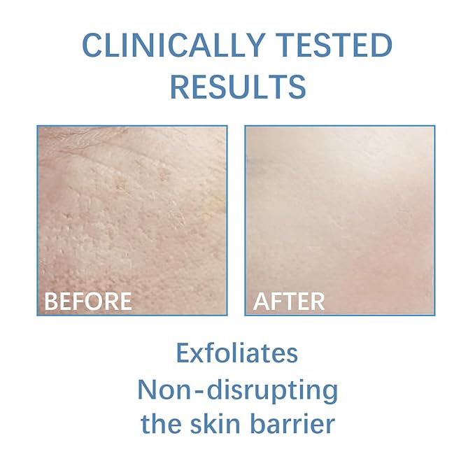 10.1 Oz - 60% Urea plus 2% Salicylic Acid for Hand & Feet Maximum Strength, Deep Moisturizing Urea Foot Cream for Calluses Dry Cracked Feet Heels Knees Elbows Dead Skin, Callus Remover