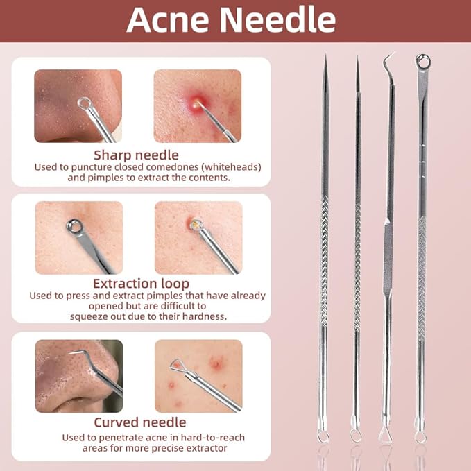 5-Speed Blackhead Remover Vacuum, Wireless Charging Nose Pore Extractor with 4 Removable Heads,Facial Vacuum Pore Cleaner,30-Second Keratin Softening, Hypoallergenic Deep Cleansing