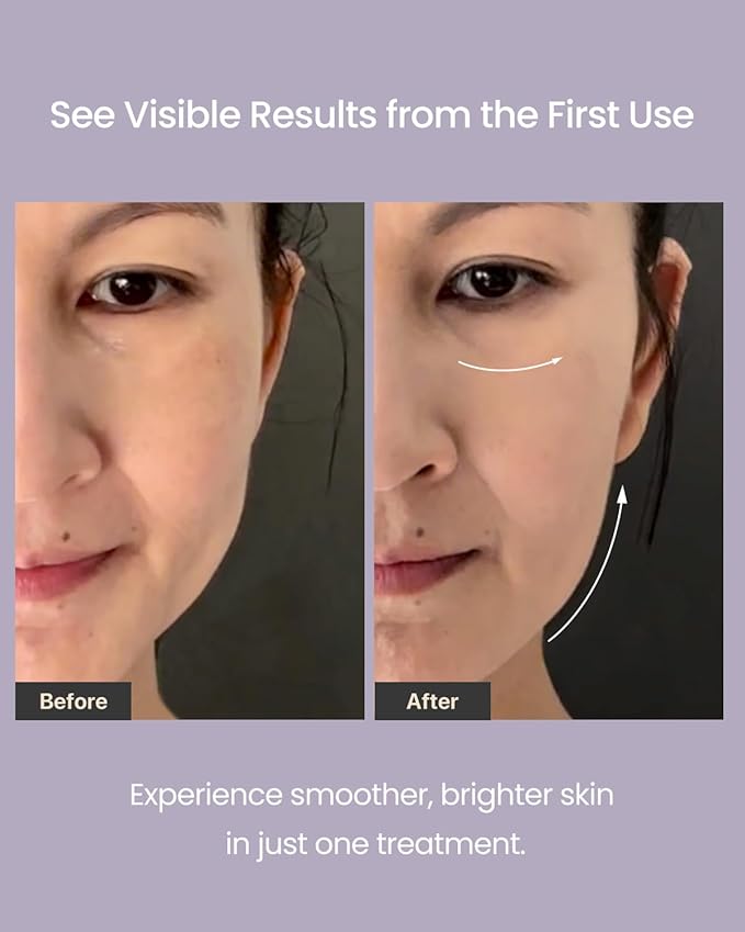 AMIRO R3 Turbo Facial Beauty Tool – Full-Face & Eye Area Skincare Enhancer for a Lifted-Looking, Smoother Appearance – Purple