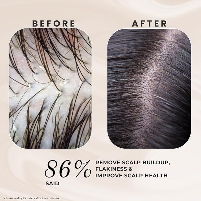 K C Scalp Detox & Hair Treatment Mask - Deep Conditioner for Dry Scalp & Damaged Hair – Scalp Care for Buildup, Flakes & Oil Control – All Hair/Scalp Types – Spa Grade Formula (FLORAL)