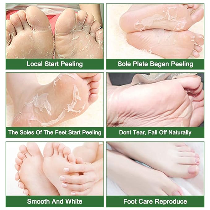 Foot Peeling Mask 5 Pack, Foot Mask Remove Dead Skin, Rough Callus and Cracked Heels, Dry Skin Moisturizer for Soft and Smooth Baby Touch Feet (Tea Tree)