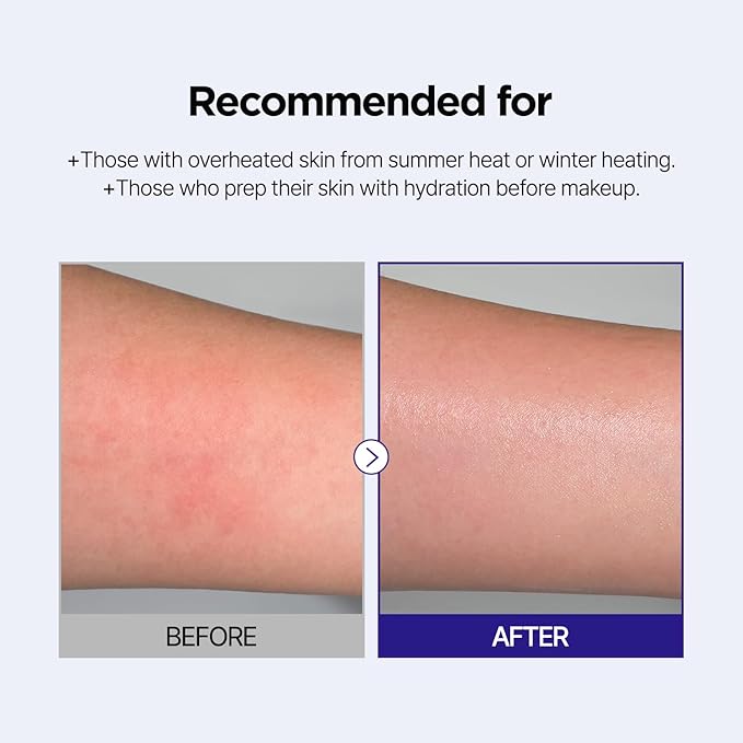 PONGDANG Dewy Glow Azulene Gel Toner Pad | Cooling Calm | Korean Gel Toner Pads with Guai Azulen, Chamomile | Soothing, Radiance & Uneven Skin Tone | Korean Skin Care