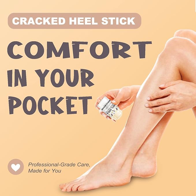 Urea Cream 40 Percent for Dry, Cracked Heels and Feet with Coconut Oil & Vanilla Planifolia, Callus Remover and Skin Softener, Maximum Strength Foot & Hand Cream – 1.41 oz