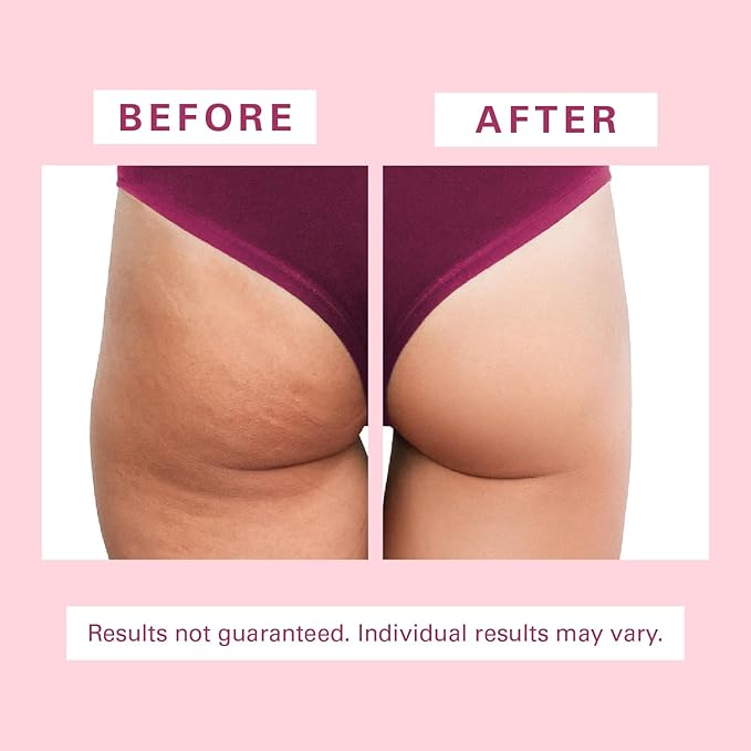 Cellulite Massager Brush, Anti-Cellulite Silicone Body Scrubber for Skin Smoothing, Toning, and Firming, Handheld Exfoliator for Scalp and Muscles by M3 Naturals