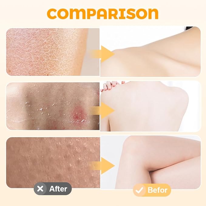 Super Soft Sunflower Suction Cup Bath Ball, 2025 New Exfoliating Bath Bath Sponge Cleaning Brush with Finger Rings for Women and Men (Pink, 4 pcs)