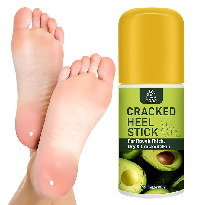 Daily Foot Moisturizer Cream, Feet Cream for Dry Cracked Heels Knees Elbows Hands, with Salicylic Acid & Macadamia Ternifolia Seed Oil & Shea Butter, Deeply Moisturize and Remove Calluses, 1.763 Fl.Oz