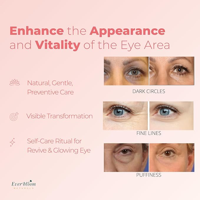 Salmon DNA PDRN Eye Serum Roller with Bakuchiol, Argireline Peptide, Caffeine for Fine Lines, Puffiness, Refreshing Care for Tired Eyes, Puffiness & Hydration, Gentle Korean Eye Treatment 0.5 fl. oz