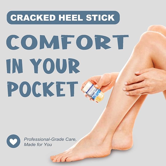 60% Urea with 2% Salicylic Acid Urea Foot Care Stick, Foot Cream Moisturizer for Dry Cracked Feet, Knees, Elbows, Hands, Moisturizes and Hydrates the Dry Skin, Callus Remover & Skin Softener -1.41oz