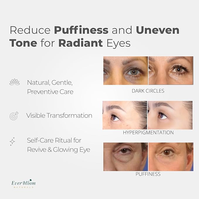 Tranexamic Acid Eye Serum Roller with Bakuchiol, Argireline Peptide, Caffeine for Dark-Circles, Hyperpigmentation,Puffiness, Skin Glow, Fine Line Care, Korean Skin Care 0.5 fl. Oz