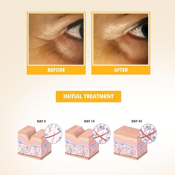 NIKA SKIN CARE - Eye Serum with Vitamin C & E, Hyaluronic Acid, Caffeine, and Swiss Apple Stem Cells - Day & Night