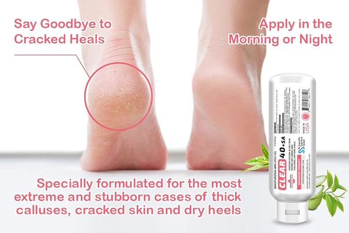 CLEAR 40 +SA, 40% Urea Gel + 2% Salicylic Acid, 8 oz w/Tea Tree & Coconut Oil, Aloe Vera, Callus & Corn Remover Softens Cracked Heels, Feet, Elbows, Hands, Nails, Superior hydration to Urea Creams