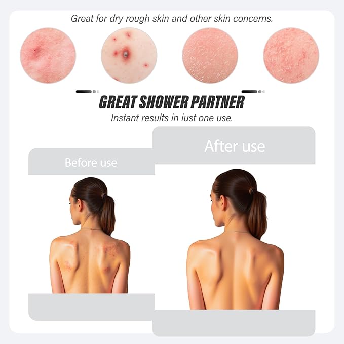 Inmorven Exfoliating Back Scrubber with Handles, Nylon Back Exfoliator, Two Sides Stretchable Pull Strap Shower Deep Cleans Skin Massages Invigorating Blood Circulation for Women Men Body (Bule)