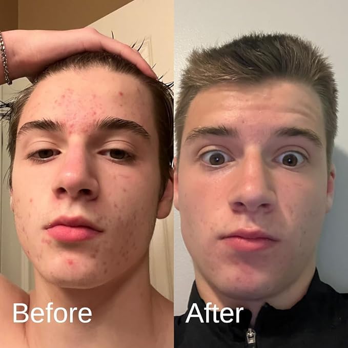 Shield Face Wash for Men and Boys, Deep Clean Gel Formula with Balancing Botanicals, Unscented, 5.1 oz, Pack of 2