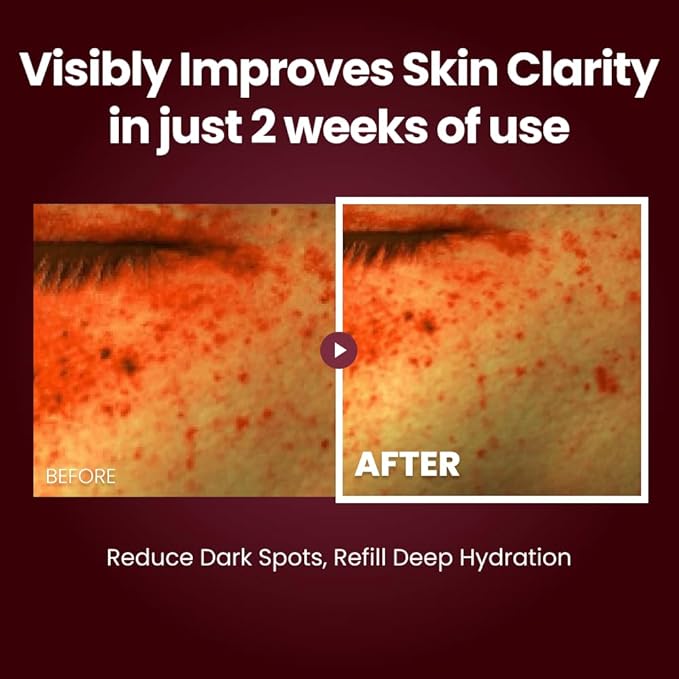 Kopher [4Ever Edition] Solution Cream, facial moisturizer for all skin types 1.69 fl. oz.