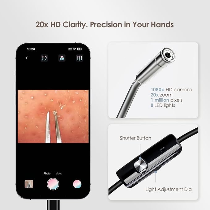 Luma 1 Visual Blackhead Remover Tweezers with Camera - Pimple Popper Tool with Camera 20x Magnification, 1080P, 8 LED Lights, with Blackhead Remover Pimple Popper Tool Kit (6 Piece Kit),Black