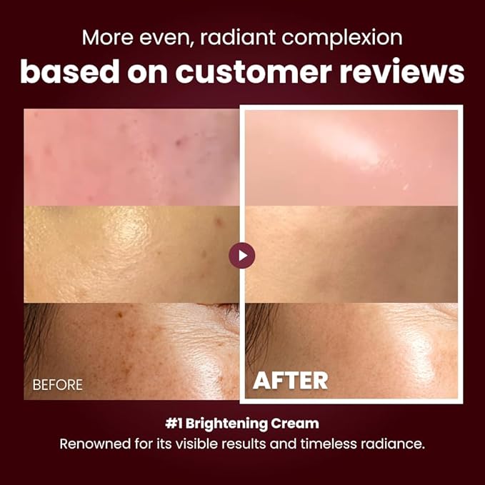 Kopher Curepair Mela Cream[4ever Edition] with 10GF Soothing & Repairing Moisturizer for Sensitive Skin - Redness Relief, Barrier Strengthening Skin, Korean Skincare (1.18 fl.oz.)