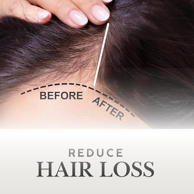 OMS Pre-Shampoo Hair Treatment Oil for Growth & Loss Prevention, Scalp Nourishing, Heat Protection, Anti-Frizz 3oz