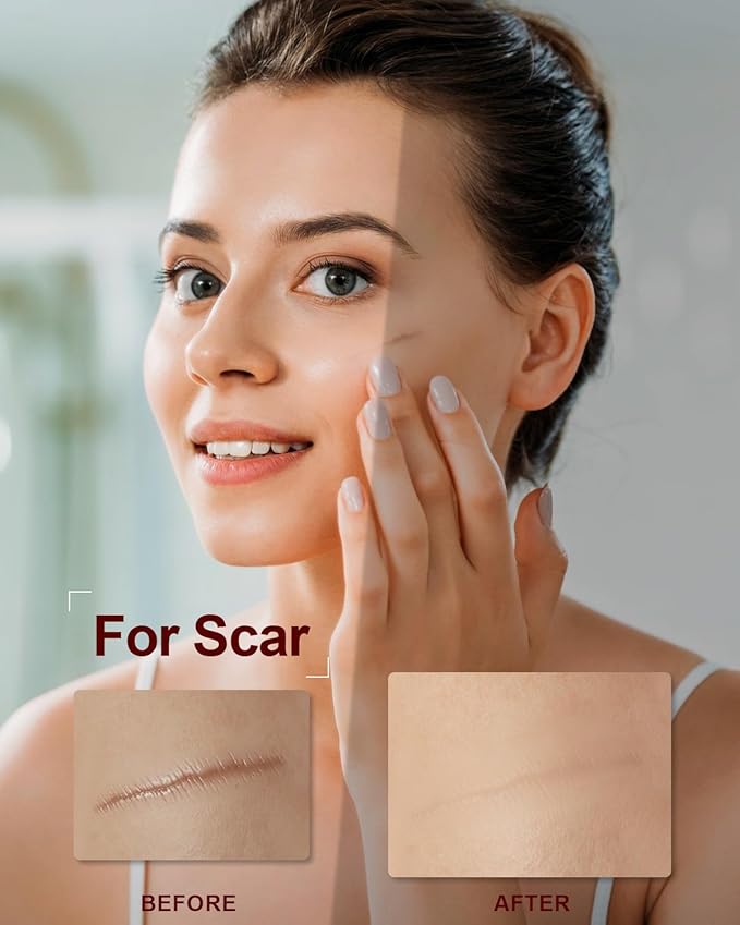 Organic Rosehip Seed Oil for Face,100 USDA Pure Rosehip Oils for Skin,Scars,Hair & Nails.2 fl Oz Cold Pressed Rose HIPS Oils for Skin Care, Anti-Aging, Scar Treatment, GUA SHA Massage Carrier Oil