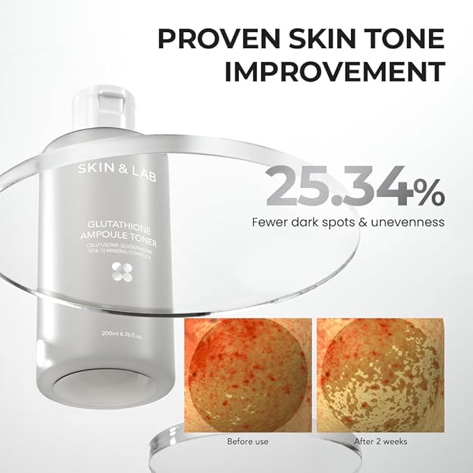 [Skin&LAB] Glutathione Ampoule Toner 6.76 fl oz, Improve Dart Spot, Hyperpigmented, Skin Clarity, Korean Toner for Sensitive Skin
