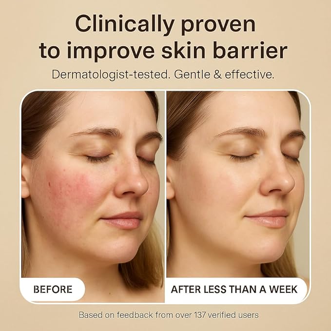 Volim Love Scrub with Hyaluronic Acid Natural Face Exfoliator for Wrinkles, Acne, Fine Lines, Blackheads & Clogged Pores