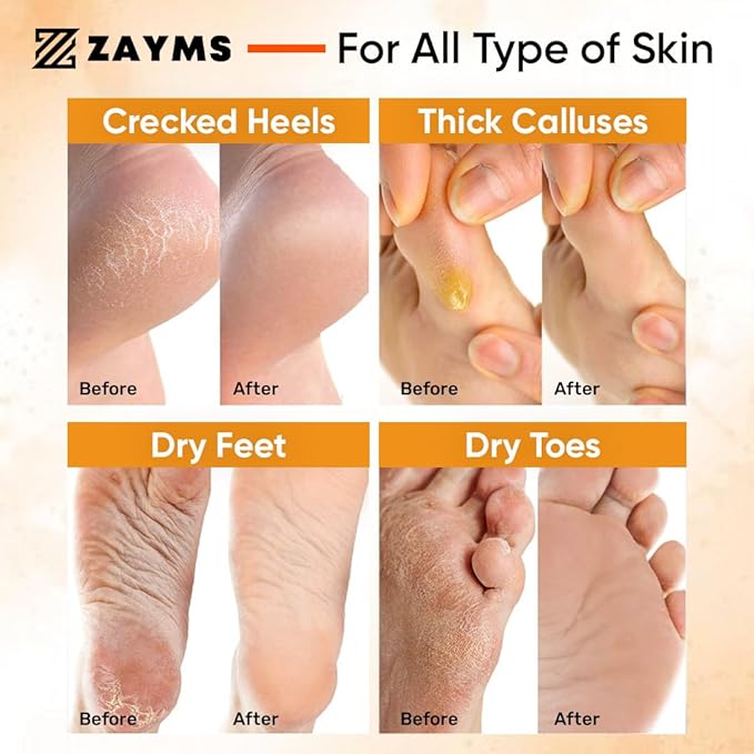 Foot Peeling Mask 5 Pack - Exfoliating Mask for Baby Soft Feet, Removes Dead Skin & Calluses, Repairs Cracked Heels, Natural Peel for Smooth, Soft Feet