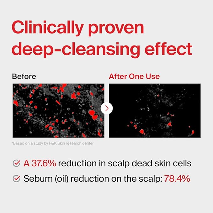 DR.FORHAIR Folligen Shampoo | Korean Hair Care | Clarifying, Anti Dandruff, Scalp | For Hair Thickening & Fuller Looking, 16.91 fl oz