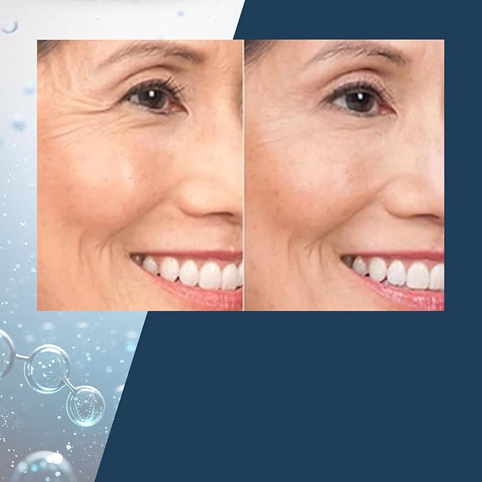 50% Glycolic Acid Peel - Face Peel Mask for Exfoliate, Acne Blemishes, Fine Lines, Wrinkles, Dark Spots & Dead Skin Cells - 1 Fl Oz