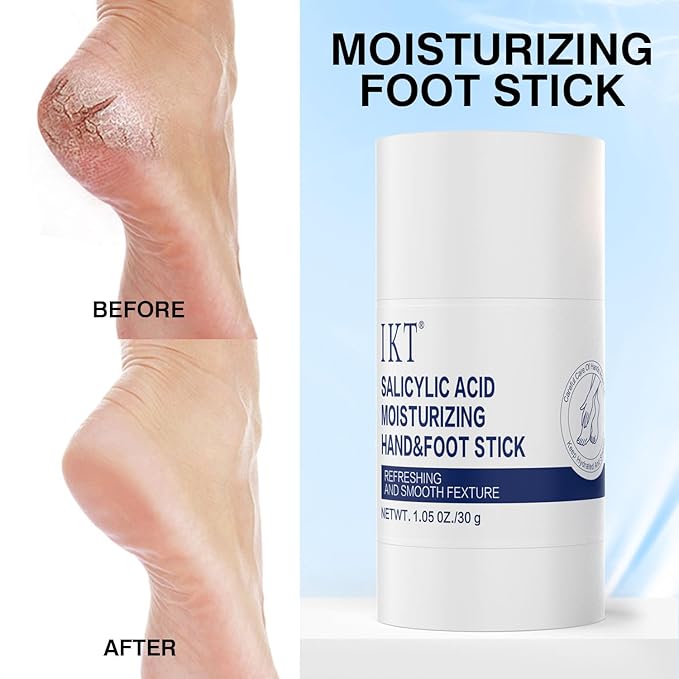 A pair of moisturizing heel socks, combined with a professional heel repair balm stick, deeply treats dry and cracked feet, providing intensive hydration and softening