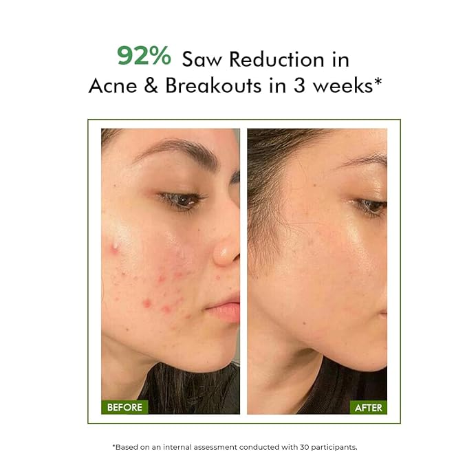 Conscious Chemist® 2% Salicylic Acid Face Wash | 100ml | Face Wash for Oily & Acne Prone Skin for Men & Women, Glycolic Acid & CICA Extract, For Glowing & Radiant Skin, Vegan & Cruelty Free - Flashfix