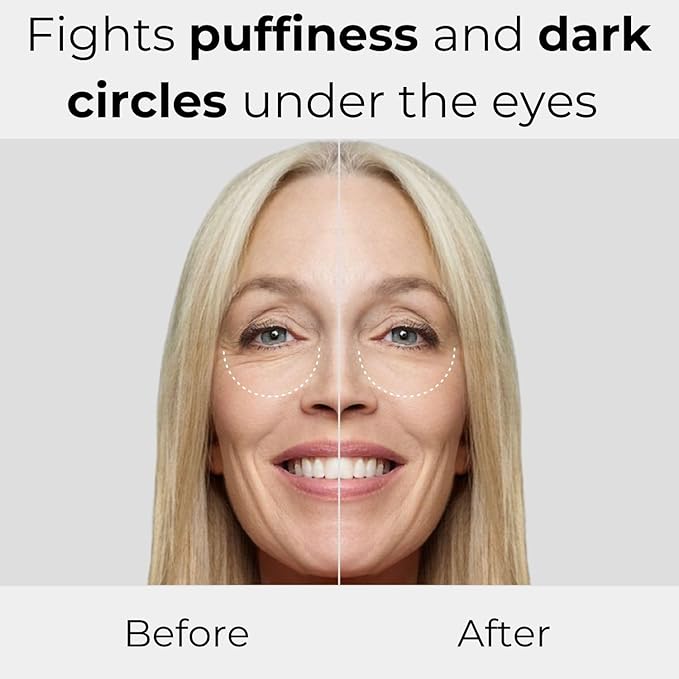 M. Asam MAGIC CARE Perfect Eye Serum - eye serum with 360° tightening effect, effectively fights puffiness & dark circles, tightens the eyelid, eye care with hyaluronic acid complex, 0.84 Fl Oz