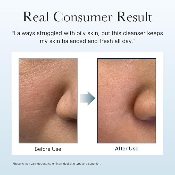 ARENCIA Hyssop Brightening & Deep-Cleansing Face Scrub & Exfoliator - for All Skin Types, Acne-Prone Skin & Blackheads (4.23oz)