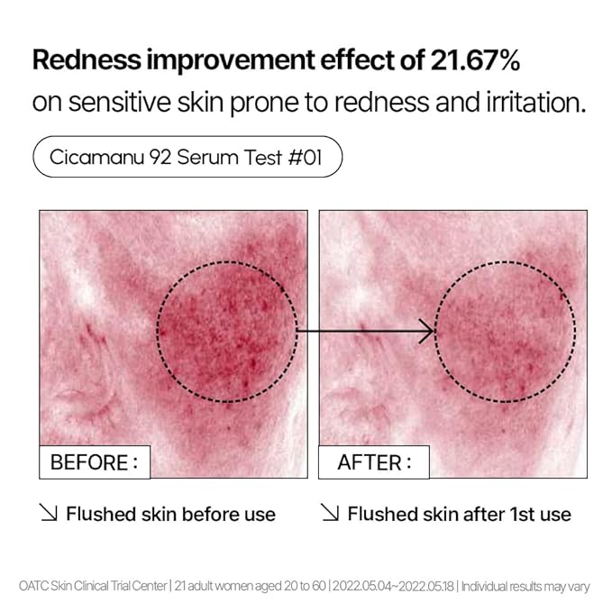 Parnell Cicamanu 92 Serum (1.01 Fl Oz) 30ml | Melatonin, Centella Asiatica | Ceramide for Overnight Recovery & Soothing Irritated Skin | Targets Hyperpigmentation & Deep Hydration | Korean Skin Care