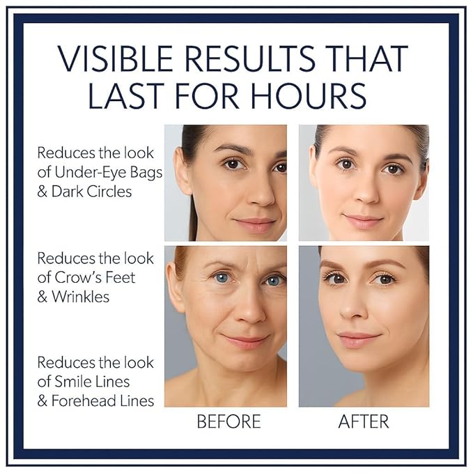 Instant Firming Eye Serum, Anti-Aging Formula for Under Bags and Wrinkles | Under Eye Cream, Wrinkle Filler, Visibly Improves for Bags Dark Circles Treatment for Puffines, 10ml(0.35 oz)