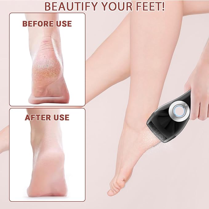 Upgraded Rechargeable Foot Callus Remover, Professional Electric Foot File, 18 in 1 Pedicure Tools Foot Care Kit Pedi Feet Care for Dead, Hard Cracked Dry Skin Ideal Gift (Black)