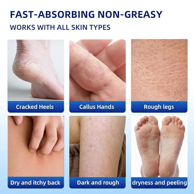 40% Urea Foot Cream with 2% Salicylic Acid Dry, Cracked Heel Treatment Callus Remover for Feet, Hands, Elbows Knees Tea Tree, Aloe Hyaluronic Acid Moisturizing Formula, 5.29 oz