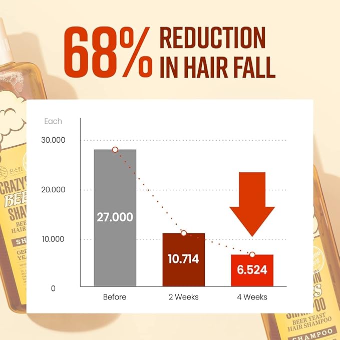 CRAZY SKIN German Beers Shampoo - 20.30 fl oz(300ml) X 2set, BIOTIN for hair loss, Rich with Beer Yeast for Regrowth and Thickening, Sulfate/Chemical free, Suitable for all hair types