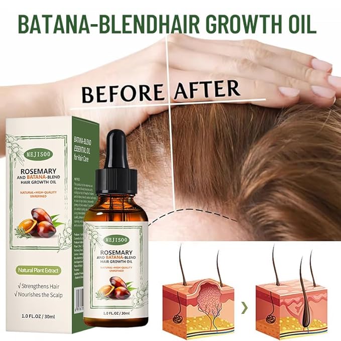 Organic Batana Rosemary Oil for Hair Growth & Anti-Hair Loss, Natural DHT Blocker Scalp Treatment for Thinning Hair, Nourishing Dry Scalp & Strengthening Follicles Cold-Pressed, Non-Greasy, 1 fl oz