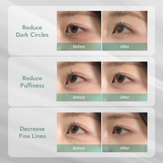 MIZON Cicaluronic Vegan De-puffing Eye Gel Patch, 24K Gold & Cica Under Eye Mask, Reduces Puffy Eyes, Dark Circles and Wrinkles (21 pairs) Stocking Stuffers