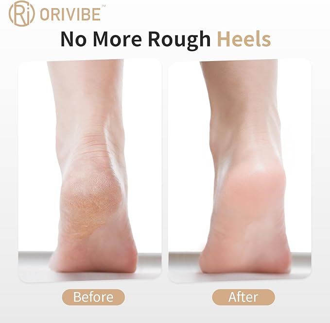 Electric Callus Remover for Feet – 2 Speeds, Fine & Coarse Rollers, USB-C Rechargeable, 60-Min Runtime, Cleaning Brush – Smooth Heels at Home with Foot File for Dead Skin Removal