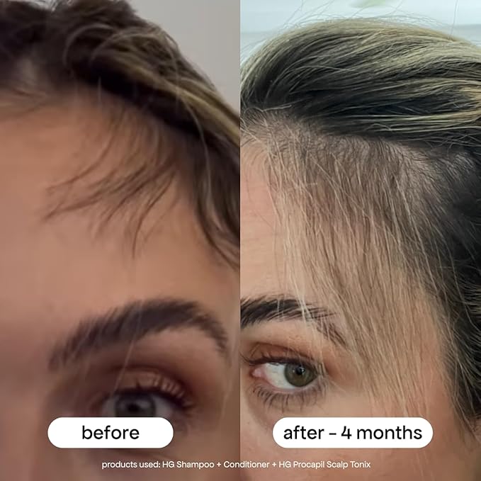 BONDIBOOST HG Anti-Thinning Hair Conditioner [16.90 fl oz] - Hydrating Hair Conditioner with Aloe Vera, Rosemary & Saw Palmetto, Promotes Thicker + Stronger-Looking Hair for Men & Women, Sulfate-Free